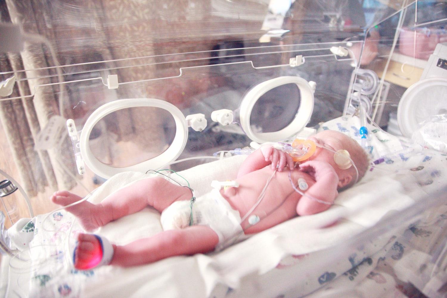 Newborn Baby in NICU to demonstrate the healthcare trend of remote patient monitoring.